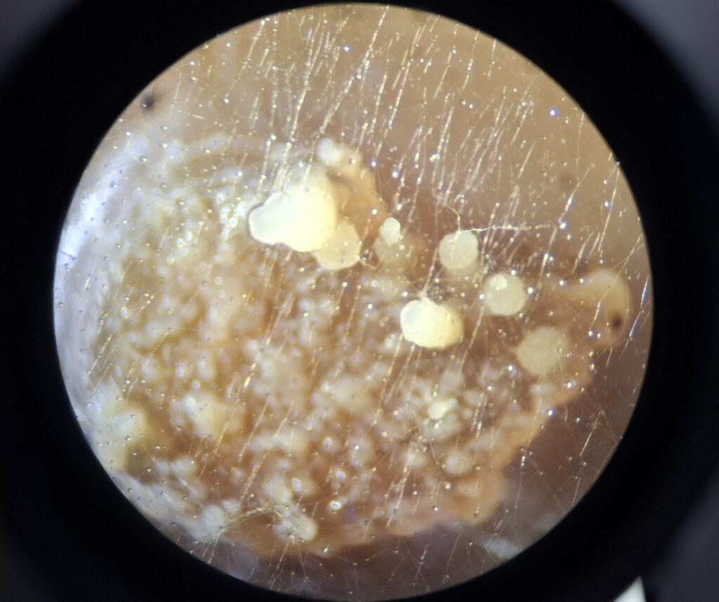 Sebacina_vermifera_Pilz