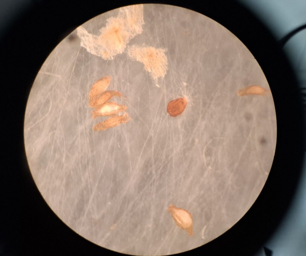 Ceratobasidium_cornigerum_Pilz