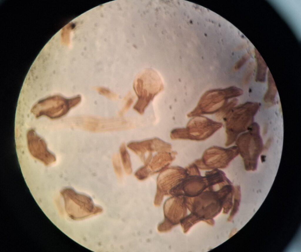 Tulasnella_calospora